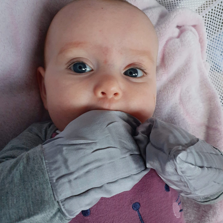 Eczema Scratch Mitten Sleeves Baby Eczema Sleeves Afterpay