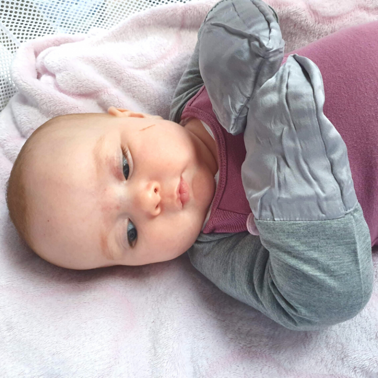Eczema Scratch Mitten Sleeves Baby Eczema Sleeves Afterpay
